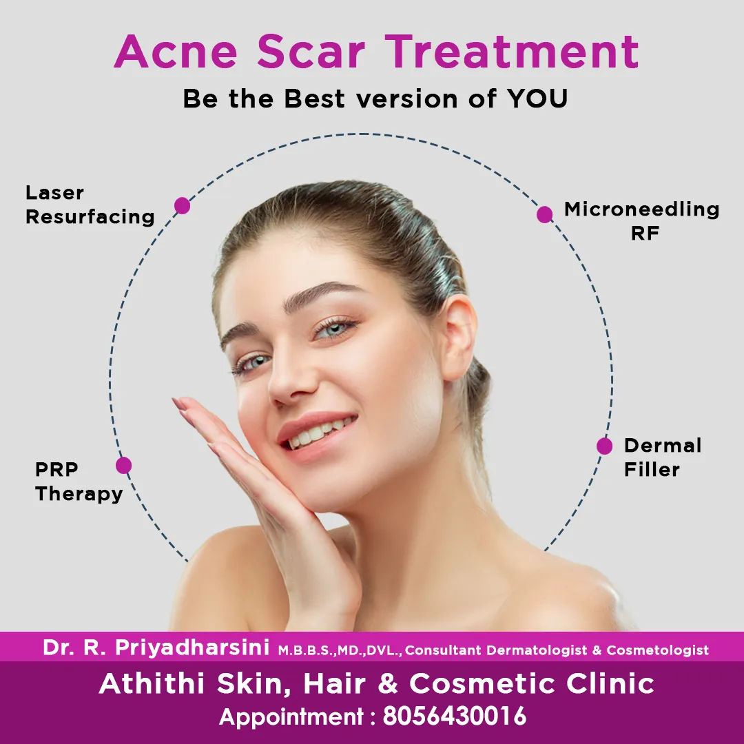 Acne scar treatment campaign creative