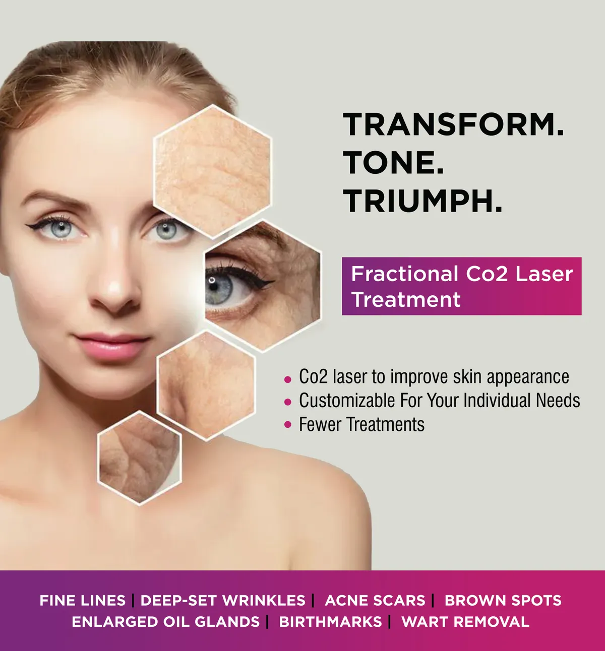 Fractional CO2 laser treatment campaign creative
