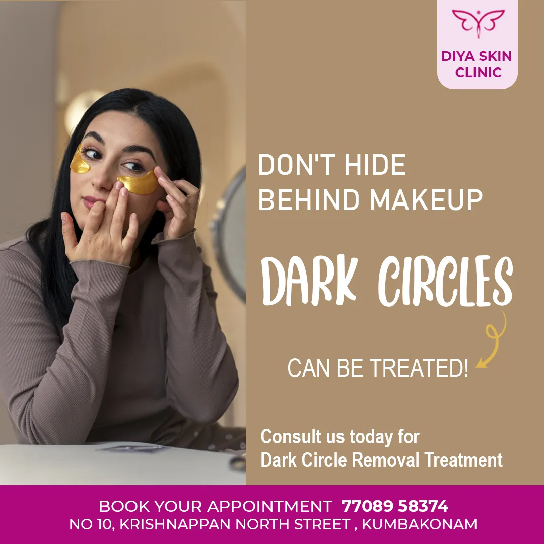 Dark circles treatment social media creative